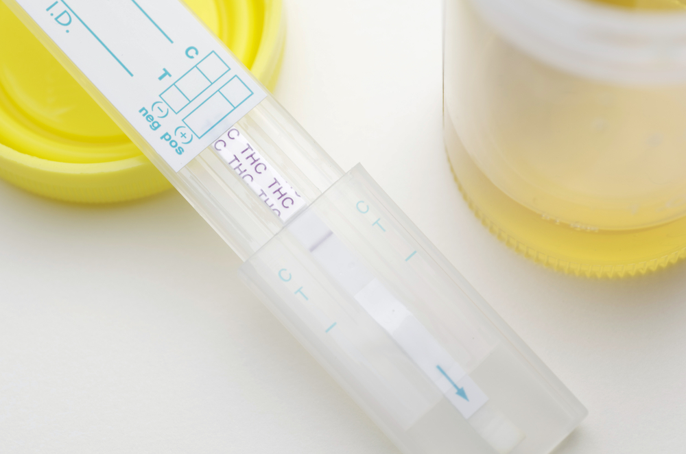 Urine THC Drug Test